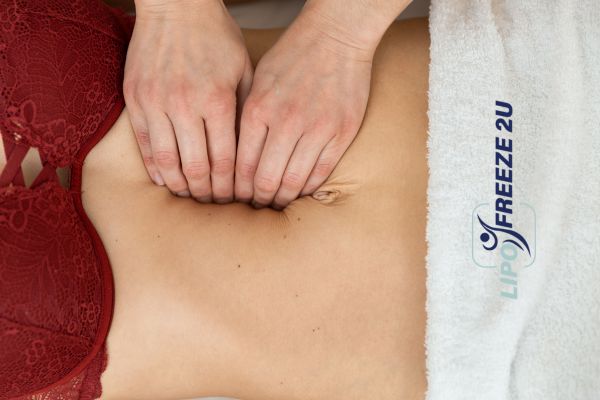 diastasis recti treatment Worthing