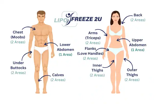 Areas you can have fat freezing treatment Worthing