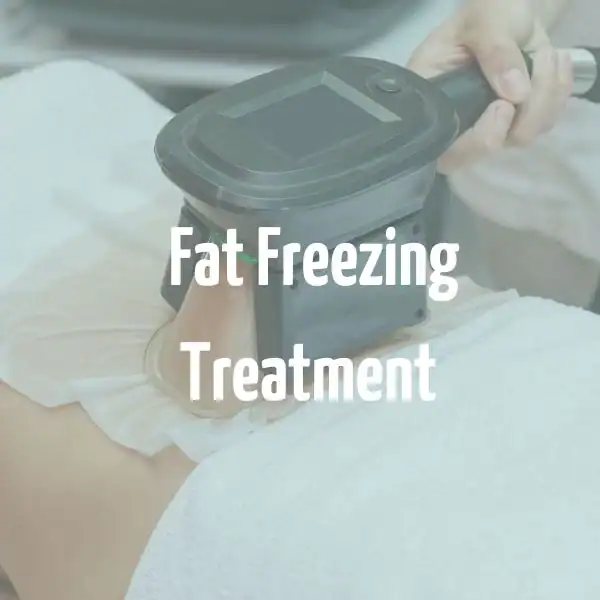 fat freezing treatment Worthing