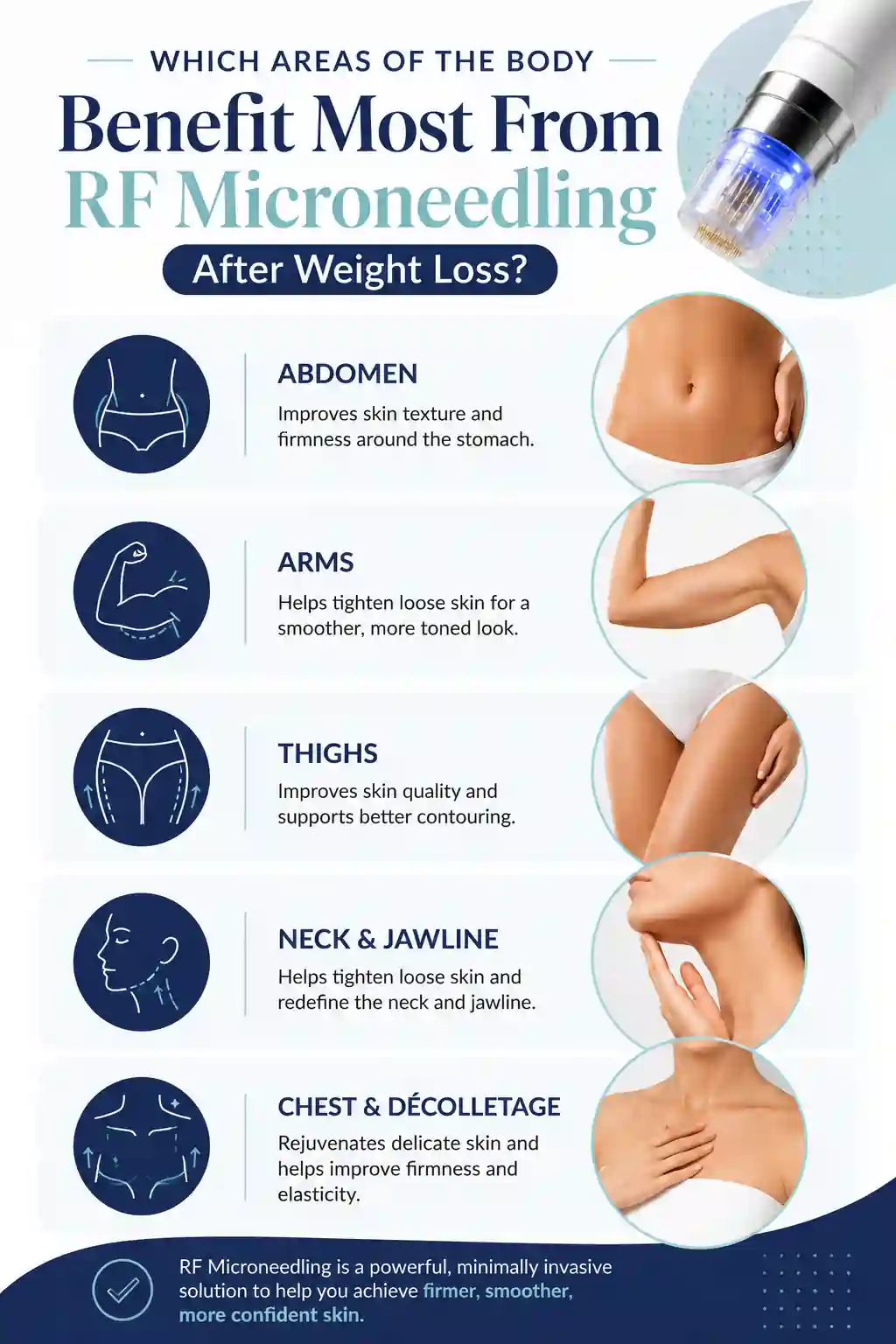 Which Areas of the Body Benefit Most From RF Microneedling After Weight Loss Worthing